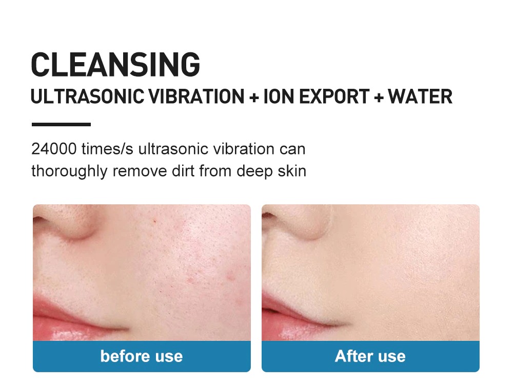 04 ems facial ultrasonic skin scrubber with description 14